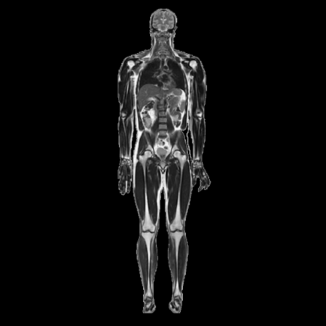 MuscleMap